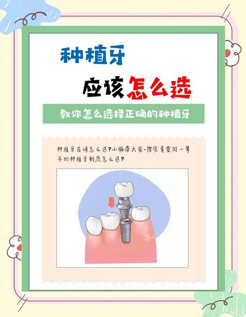 种满口牙好不好_牙满口种植_满口种牙