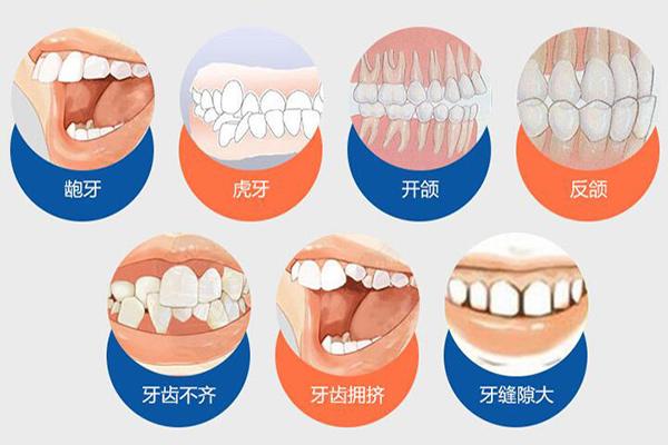 广州合肥隐形牙齿矫正费用贵不贵？要多少钱？