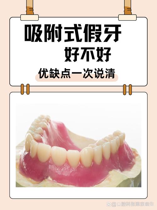 广州缺牙不种牙？活动假牙固定桥吸附性义齿哪个好