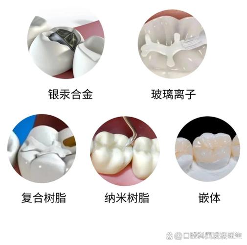 广州补牙用什么材料好？哪种补牙材料最靠谱？
