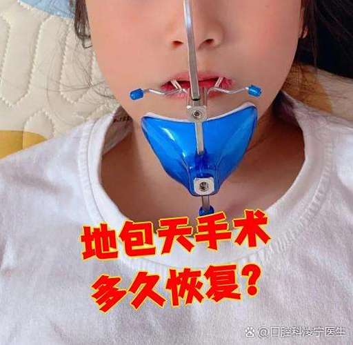 广州正颌手术矫正牙齿靠谱吗，效果能维持多久