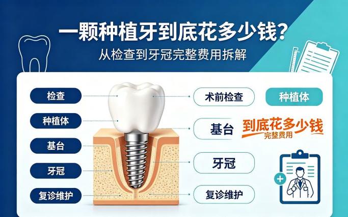 广州种一颗牙到底要花多少钱？