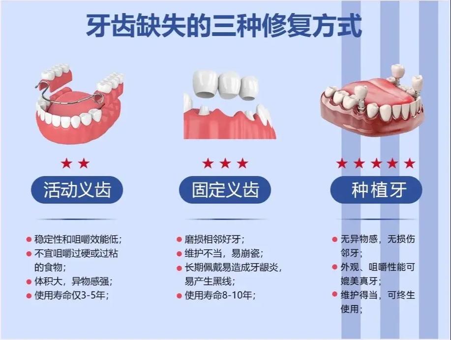 广州缺牙不种牙还有哪些靠谱的修复方法
