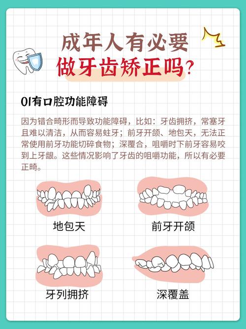 广州40岁做牙齿矫正来得及吗 牙医告诉你真实答案
