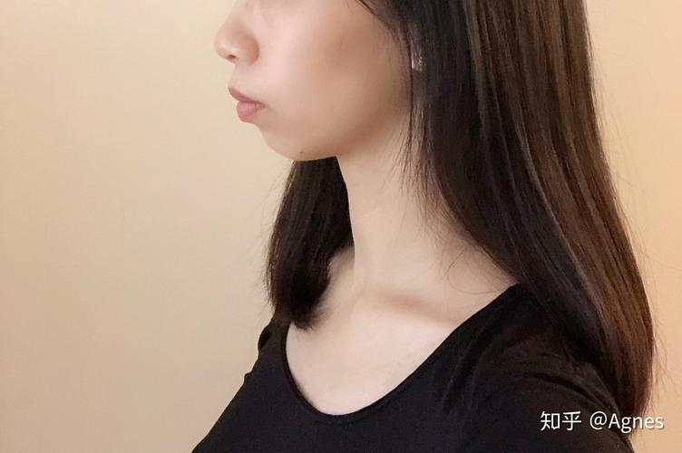 广州深圳龙岗隐适美矫正要多久？看完这篇就清楚了
