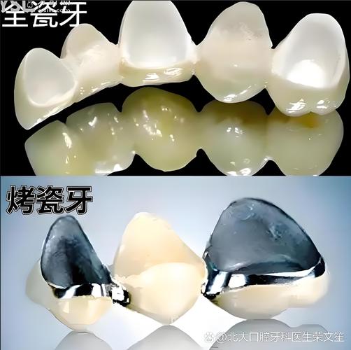 广州天津种一颗牙要多少钱？看完这篇就懂了