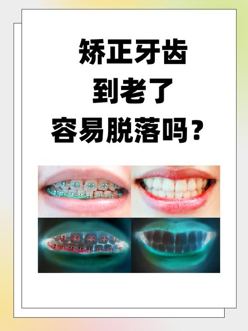 广州43岁矫正牙齿晚不晚 过来人告诉你答案