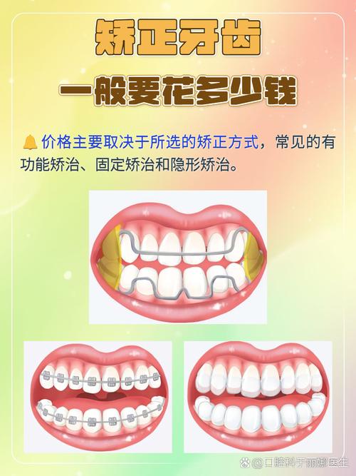12岁地包天牙齿矫正需要多少钱_矫正地包天要拔牙吗_牙齿矫正地包天需要多久