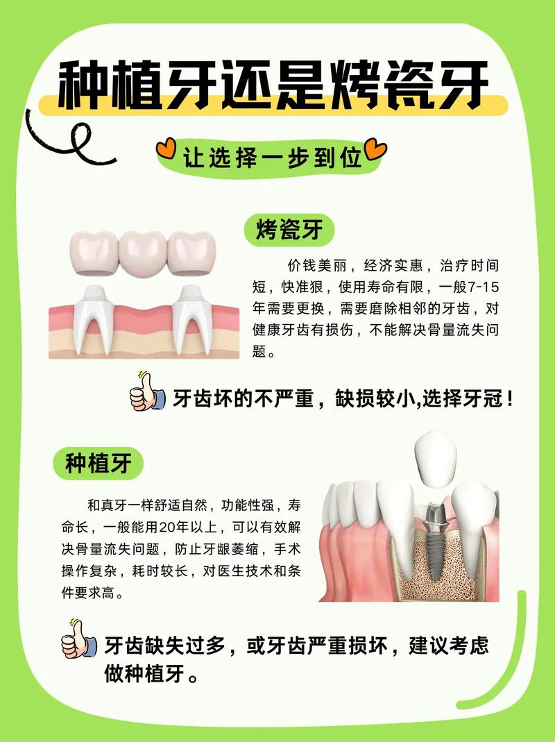 广州烤瓷牙还是种植牙 牙医教你选对修复方式
