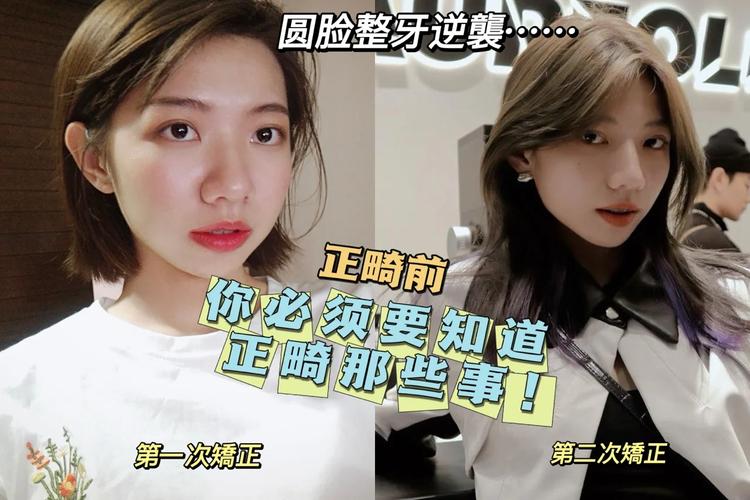 广州23岁整牙还来得及吗？过来人说实话