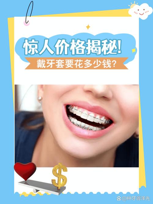广州矫正牙齿透明牙套到底要花多少钱 看完心里有底