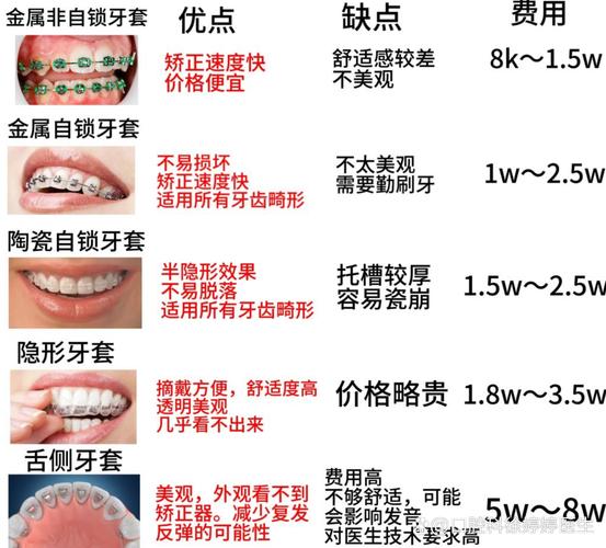 北京口腔医院正畸费用_深圳福田青少年钢丝正畸费用_苏州牙齿正畸费用