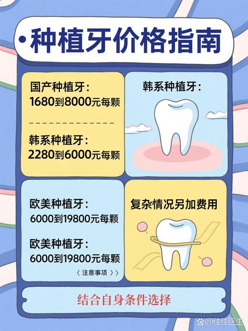 广州博士口腔医院种植牙 效果好不好多少钱一颗