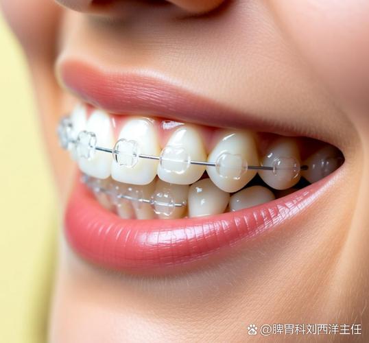 广州深圳龙华国产隐形矫正靠谱吗？性价比最高的牙科是哪家？