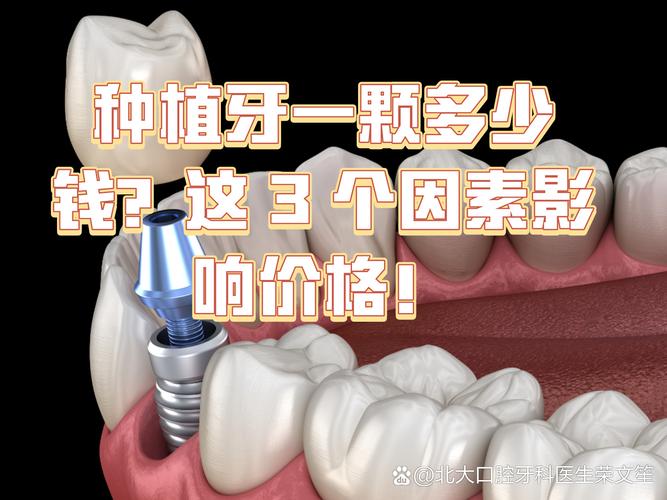 广州镶一颗种牙要多少钱 影响种植牙费用的关键因素梳理