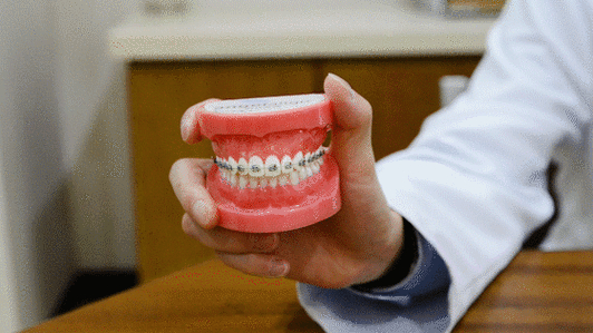 广州深圳蛇口隐形矫正到底多少钱？2026年真实费用大揭秘