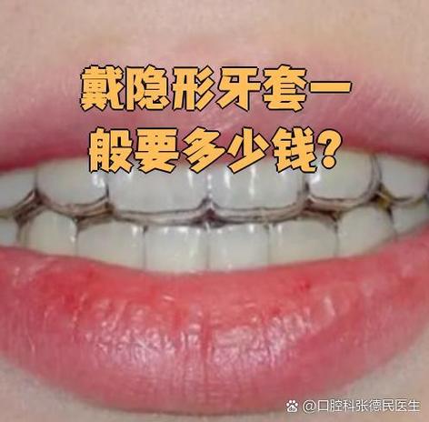 蛇口隐形矫正价格_深圳隐形矫正多少钱_隐形矫正厂家