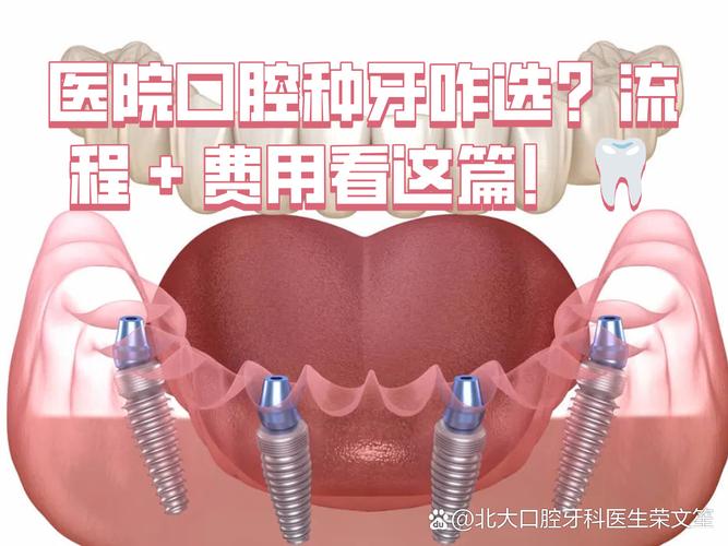 龙岗种植牙医院电话_龙岗中心城种植牙医院_龙岗医院种牙费用对比