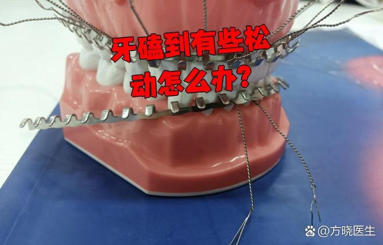 广州孩子牙齿磕碰松动了怎么办？多久能自己长好