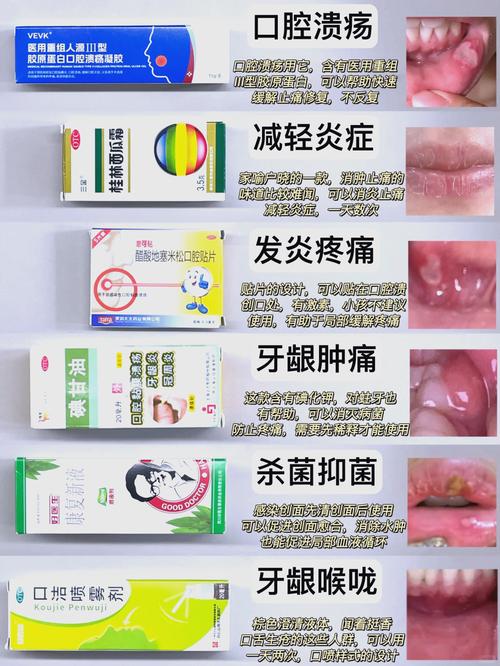 广州小孩口腔溃疡吃什么好的快？收下这份家庭偏方与饮食指南，轻松缓解娃的疼痛