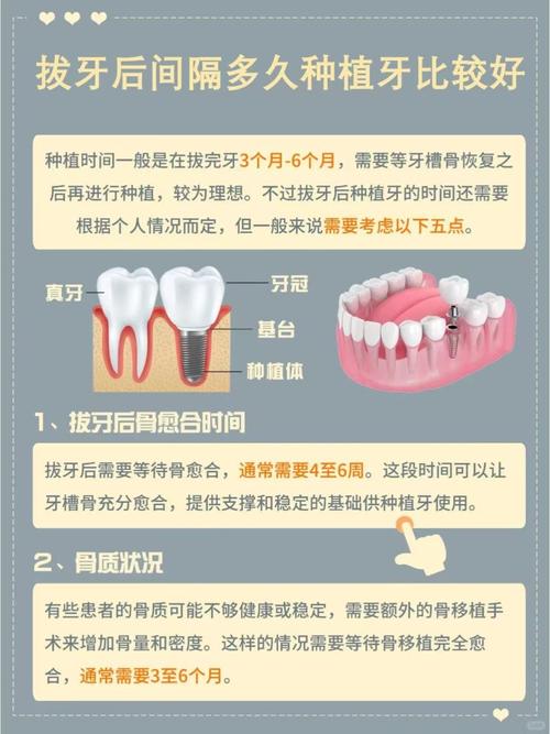 广州牙齿掉了可以植吗？种植牙疼不疼？一文给你讲清楚