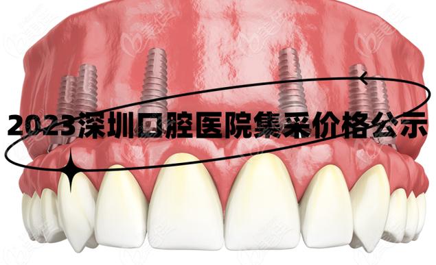 广州深圳种牙集采落地，到底能省多少钱？