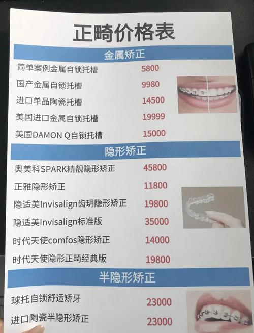广州15岁女孩牙齿矫正多少钱 2026年费用明细与省钱攻略