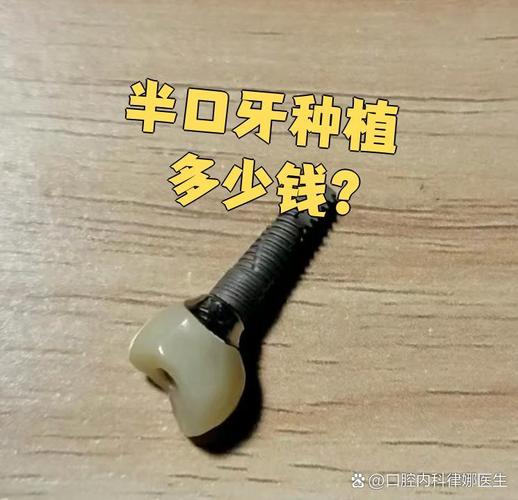 广州深圳宝安半口种牙多少钱 中老年价格详解