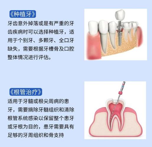 根管的尽头是拔牙吗_根管治疗的尽头是种牙吗_根管治疗尽头为何是拔牙