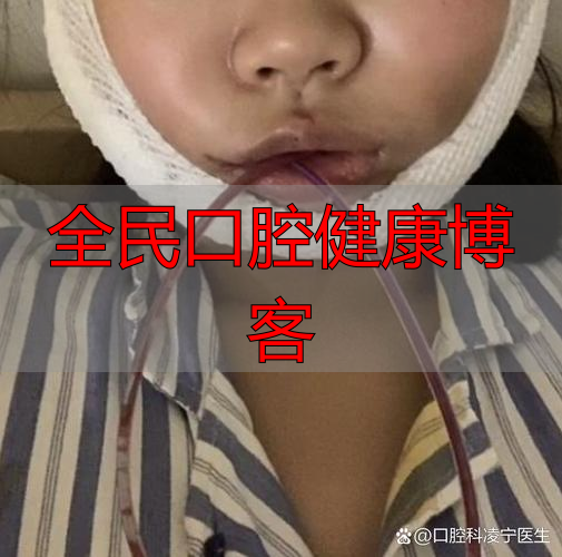 广州口腔颌面部受伤啥特点？不只影响呼吸进食，感染风险也很高