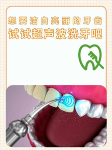 广州自己用超声波洗牙安全吗？洗牙是医疗行为，别自己瞎搞