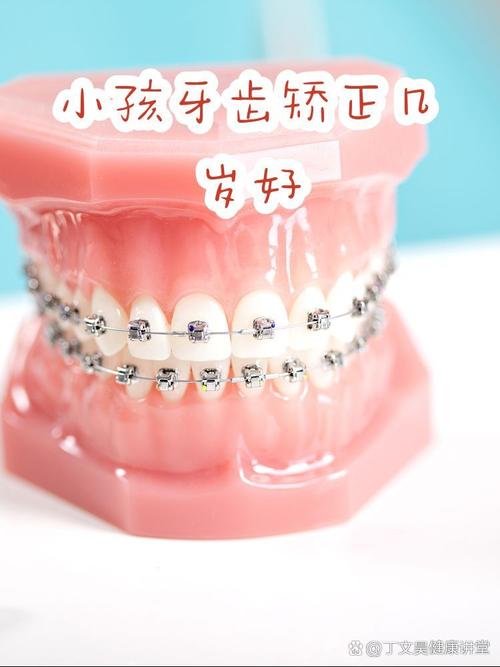 广州16岁牙齿矫正晚吗？医生：抓住黄金期，效果一样好