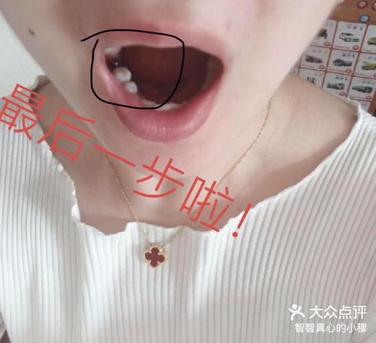 广州宝安新安种植牙哪家医院好？真实体验告诉你