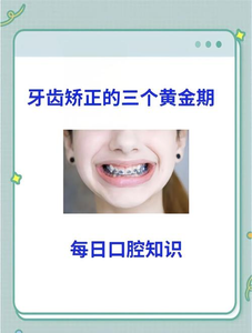 广州16岁矫正牙齿真的晚吗？抓住黄金期的尾巴，效果一样好