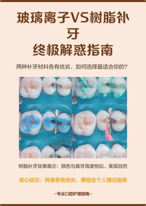 广州补牙材料有哪几种？牙医详解复合树脂和玻璃离子的优缺点