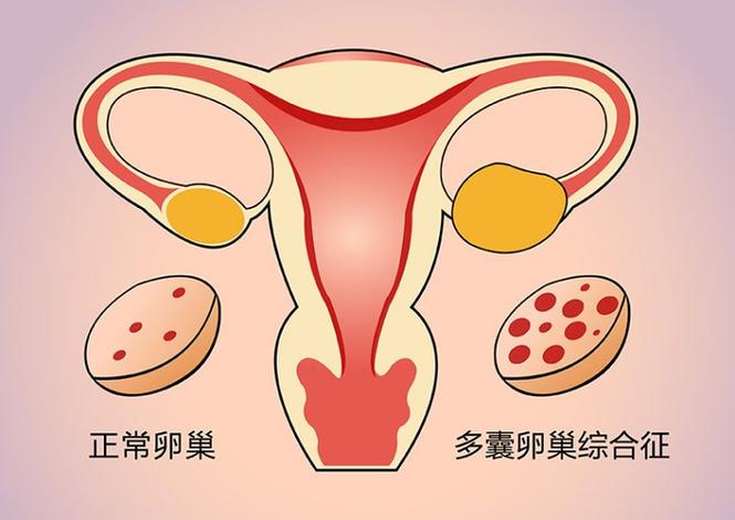 广州三代试管囊胚筛查是什么，跟一代二代试管有啥区别