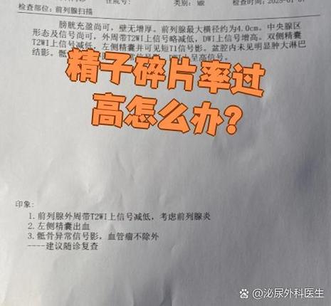 广州精子DNA碎片率高怎么办 影响生育吗