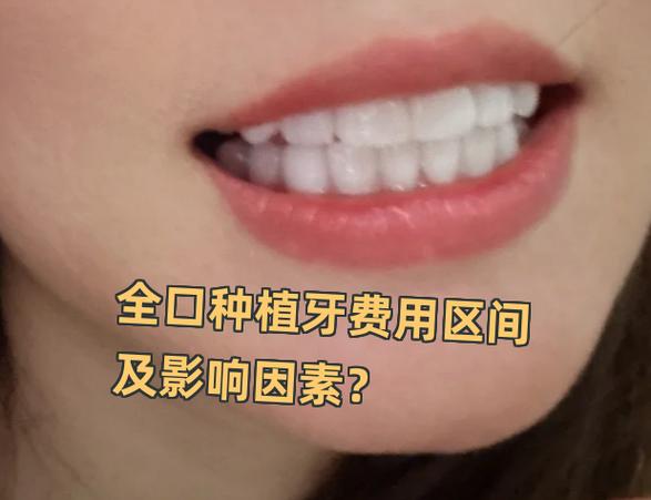 深圳罗湖骨量不足全口种牙费用_罗湖医院种一颗牙要多少钱_罗湖种牙哪里最好