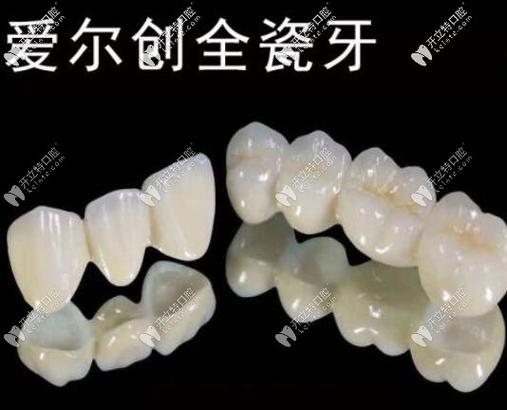 深圳烤瓷牙_深圳全瓷牙厂家_深圳全瓷牙哪家牙科靠谱