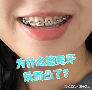 成人矫正龅牙还有效果吗_成人矫正龅牙的原理_成人能矫正龅牙吗