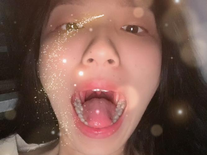 广州口腔检查第一视角真的有用吗？