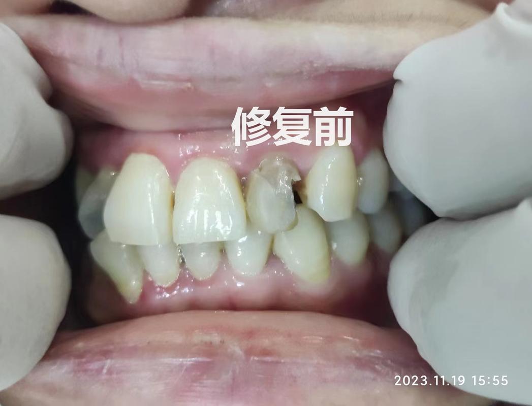 广州口腔诊疗服务怎么挑不踩坑？看牙前你最好先把这几条搞明白