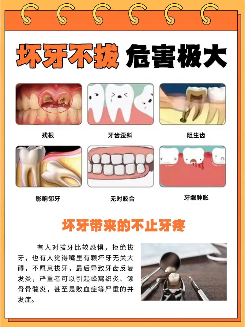 广州大牙拔掉后不种植 小心这些后果