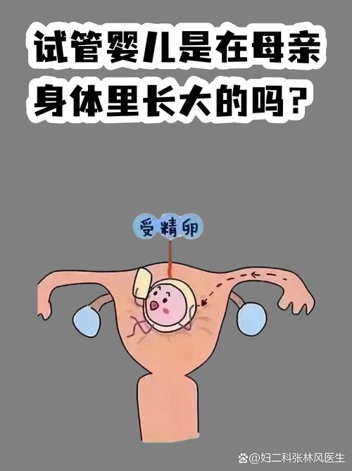 广州试管婴儿常见误区有哪些 专家一次说清