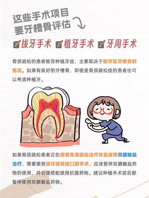 骨质疏松能种牙吗_牙槽骨骨质疏松种植牙_种牙医生说骨质疏松