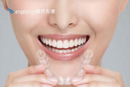广州深圳成年人牙缝大怎么矫正？隐形还是烤瓷更靠谱？