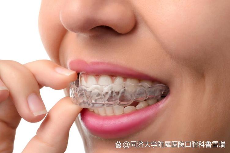 矫正牙可以只做上面一排吗_矫正牙可以不拔牙吗_可以单独矫正一颗牙吗