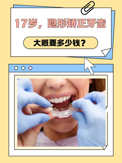 广州德韩隐形矫正牙齿效果好吗 价格多少