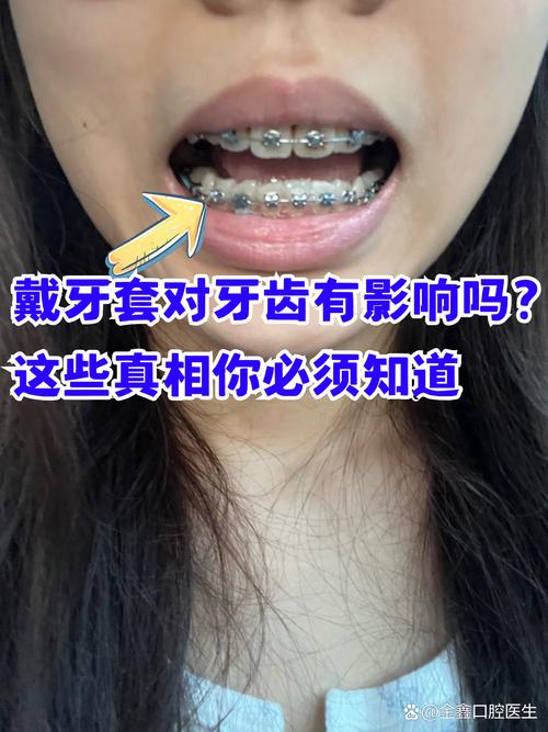 广州成人矫正牙齿口腔值得做吗 这些真相医生不会主动说
