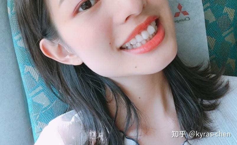 广州成人门牙不齐矫正真的很简单吗